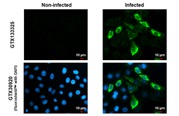 Anti-Zika virus Envelope protein antibody used in Immunocytochemistry/ Immunofluorescence (ICC/IF). GTX133325